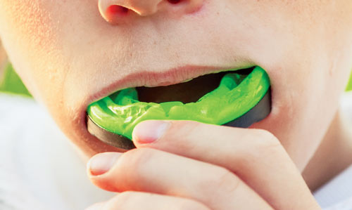 mouth guard for dental